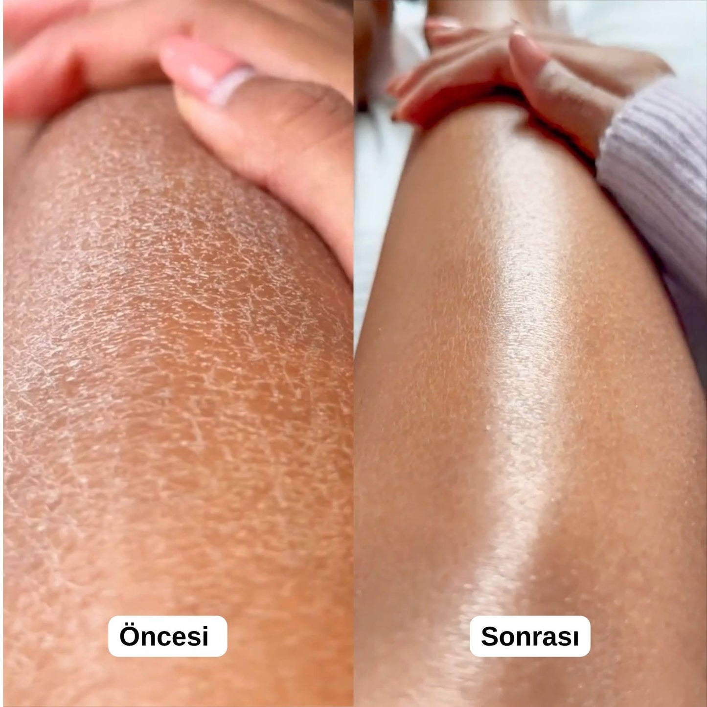 EcoScrub™ Duş Lifi
